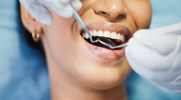 Best Emergency Dental Care for Broken or Chipped Teeth in Quinnesec, MI