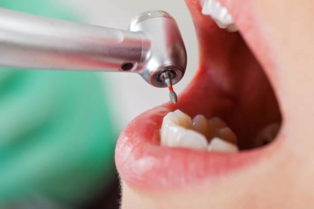 Best Cosmetic Emergency Dentistry in Quinnesec, MI